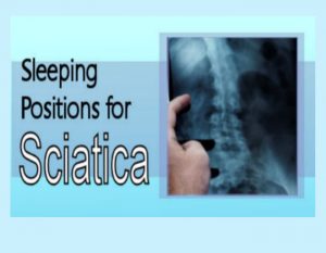 sleeping position for sciatica
