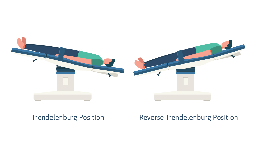 trendelenburg vs reverse trendelenburg position