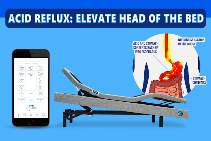 elevating head of the bed acid reflux