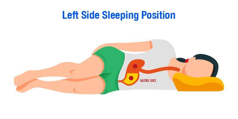 best sleeping position for acid reflux