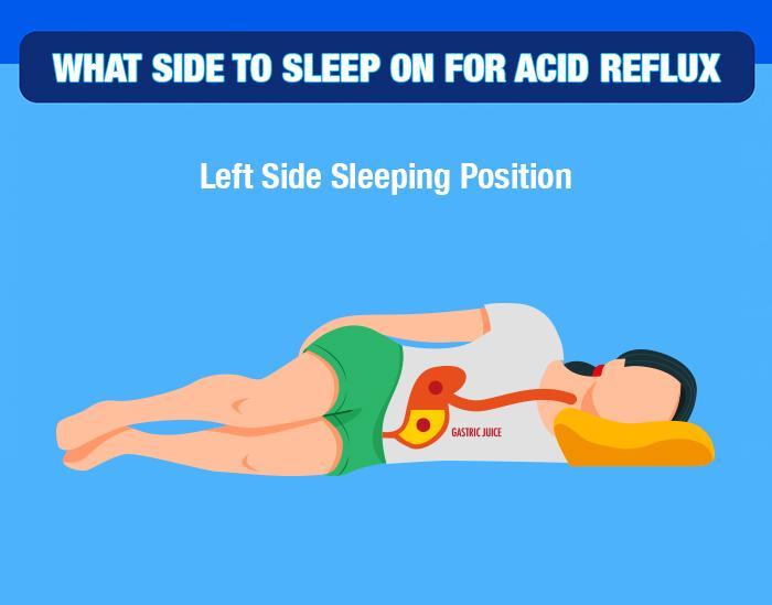 what side to sleep on for acid reflux and gerd